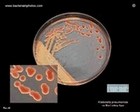klebsiella pneumoniae on MacConkey agar